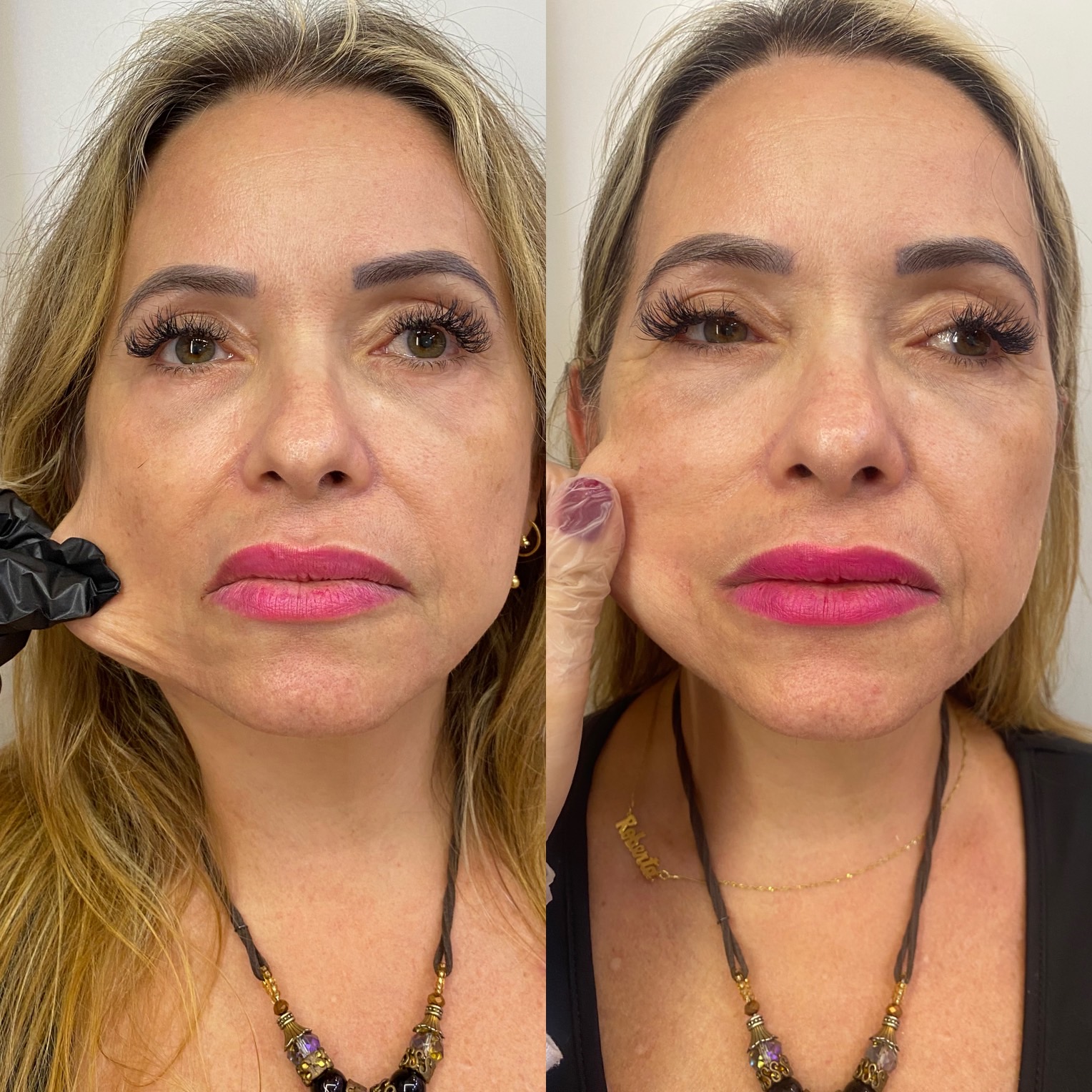 Transformação 2