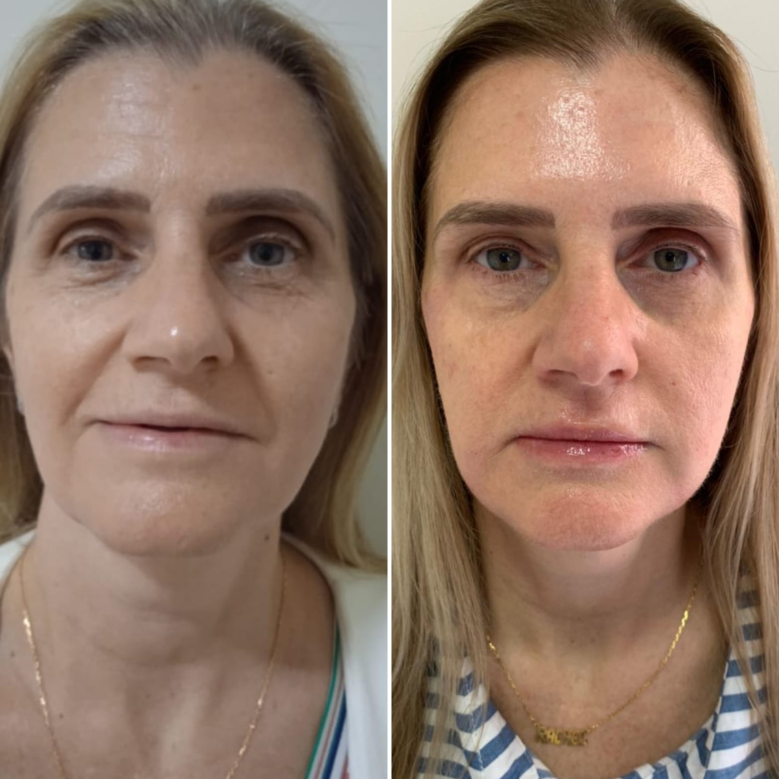 Transformação 7