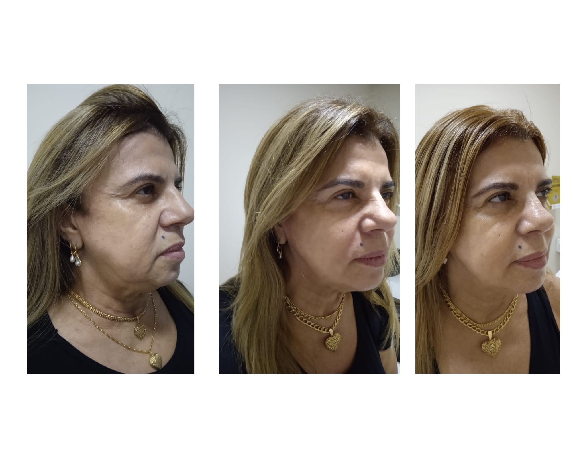 Transformação 8